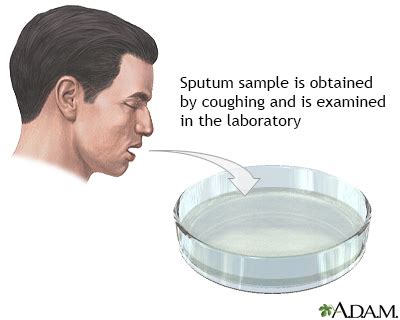 sputum test results how long|Sputum culture: MedlinePlus Medical Encyclopedia.